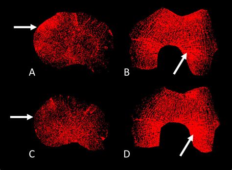 trabecular thickness measurement|trabecular bone changes in women.